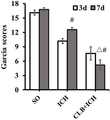 Glymphatic Drainage Blocking Aggravates Brain Edema, Neuroinflammation via Modulating TNF-α, IL-10, and AQP4 After Intracerebral Hemorrhage in Rats